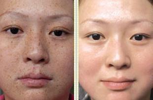 解斑爆料最新,揭秘娱乐圈最新热点事件内幕